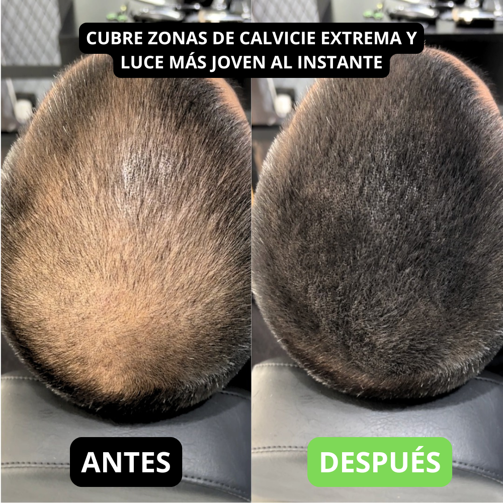 Hair Volume Powder for Men & women