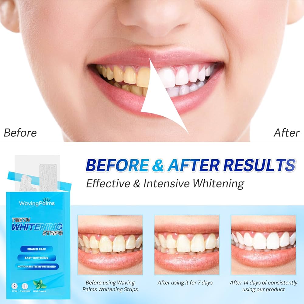 Teeth Whitening Strips (Ultra Strong Whitening)