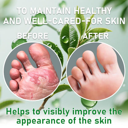 🌿 Umax Antimicrobial Foot Sanitiser Spray with Tea Tree Oil