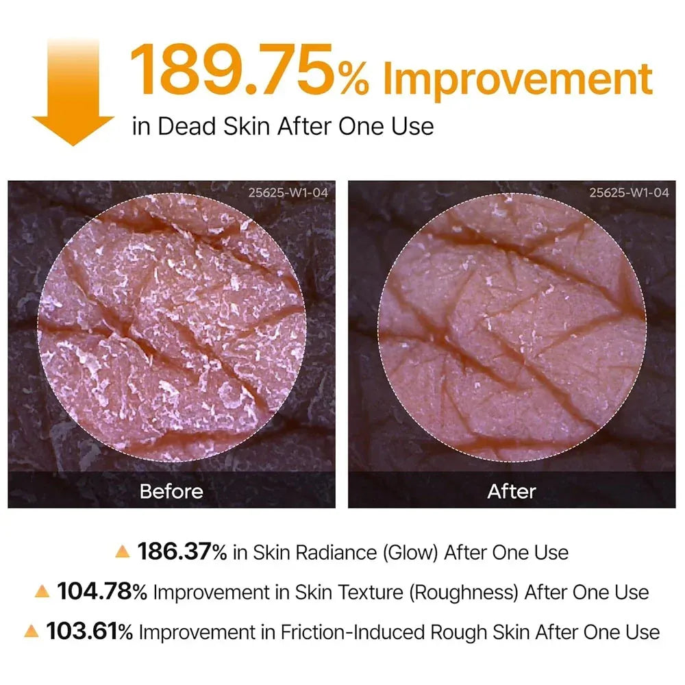 Dr. Melaxin Kojic Acid & Turmeric Body Peeling Spray – Exfoliating & Glow Care