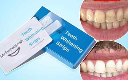 Teeth Whitening Strips (Ultra Strong Whitening)